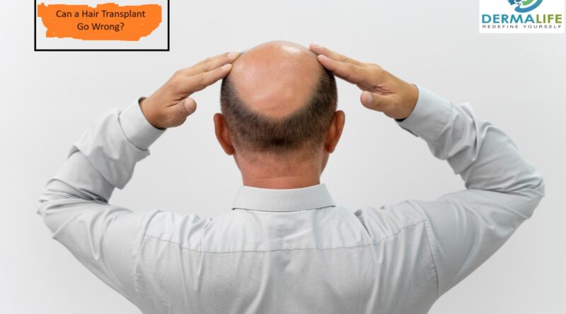 Can a Hair Transplant Go Wrong?